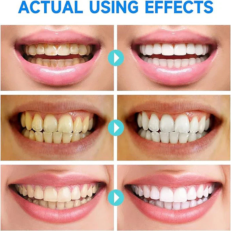 Lushbleu™ Niacinamide Whitening Toothpaste
