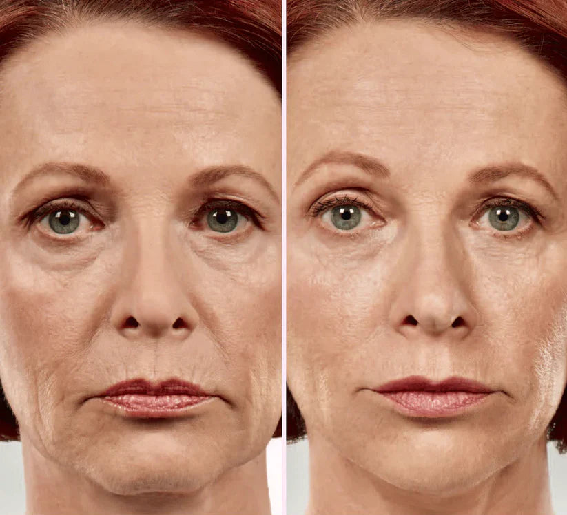 V-Face Lifting Invisible Adhesive Tape